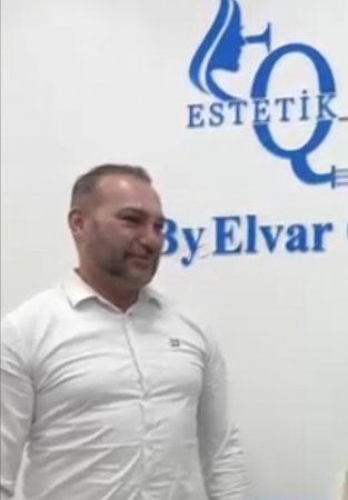 Davinçi Estetikdə həkim olmadan çalışan Elvar Quluzadə…. Bu klinikanı kimlər himayə edir? -Araşdırma